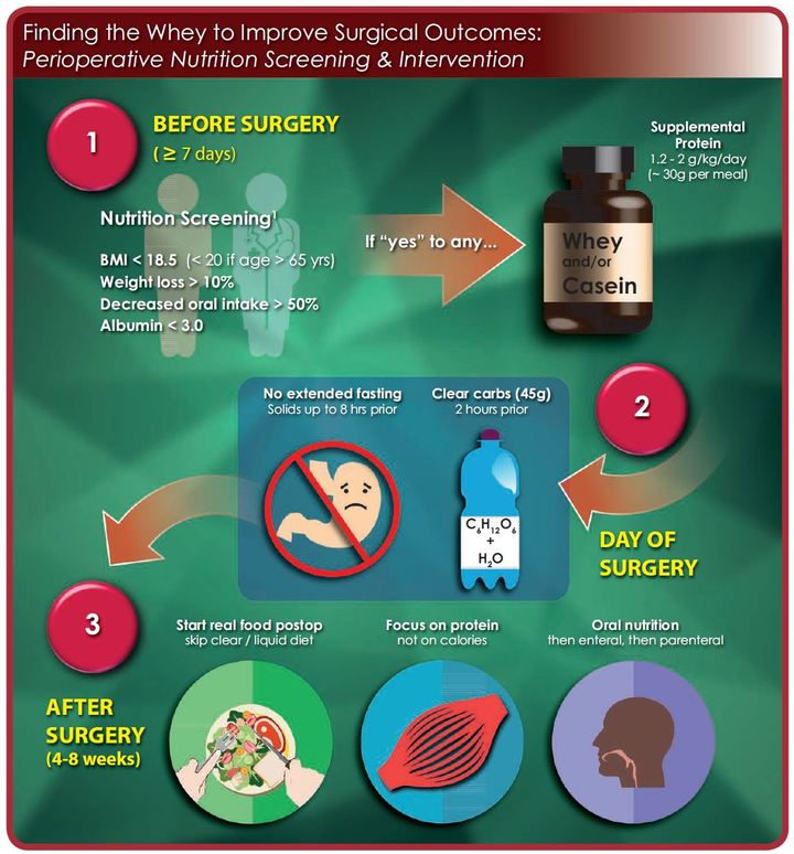 While the majority of patients presenting for gastrointestinal surgery are malnourished and data have shown an associated increased risk for postoperative morbidity and mortality, only a small portion of patients receive any preoperative nutrition intervention, as few hospitals have a formal nutrition screening process. This is in spite of surgeons belief in adequate nutrition for outcome improvement and demonstrated cost savings for nutritional interventions. In this infographic, we review a novel perioperative nutrition screening tool and strategy for improving perioperative nutritional status, which optimally begins weeks before the planned surgery and extends months beyond hospital discharge until the patient has achieved full recovery. BMI indicates body mass index. While the majority of patients presenting for gastrointestinal surgery are malnourished and data have shown an associated increased risk for postoperative morbidity and mortality, only a small portion of patients receive any preoperative nutrition intervention, as few hospitals have a formal nutrition screening process. This is in spite of surgeons belief in adequate nutrition for outcome improvement and demonstrated cost savings for nutritional interventions. In this infographic, we review a novel perioperative nutrition screening tool and strategy for improving perioperative nutritional status, which optimally begins weeks before the planned surgery and extends months beyond hospital discharge until the patient has achieved full recovery. BMI indicates body mass index.