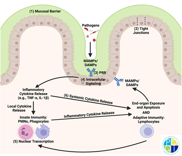 Fig. 3 Consequences of GI barrier failure. Injury to the GI tract can occur from intraluminal and extraluminal sources. Regardless of the source
of injury, intestinal epithelial cells and innate and adaptive immune cells in the lamina propria release chemical messages (cytokines, chemokines,
and DAMPs) that act locally and travel through the blood and lymph, resulting in infammation throughout the GI system and the entire body.
The numbers in this fgure correspond to the potential therapeutic targets, found in Table 2. DAMP, damage-associated molecular pattern; MAMP,
microbe-associated molecular pattern; PMN, polymorphonuclear leukocytes; PRR, pattern recognition receptor.