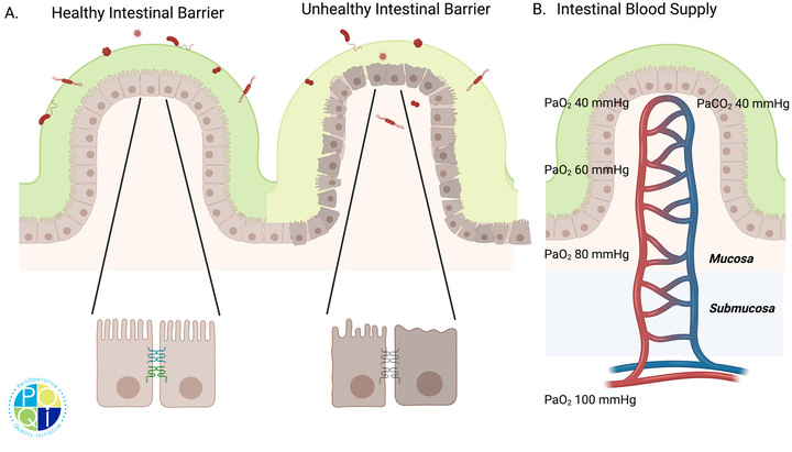 Fig. 1 The gastrointestinal epithelium in health and disease. A A healthy intestinal barrier consists of intestinal epithelial cells that are constantly
renewed through maturation and migration of multipotent crypt progenitors, and intact junctions that hold epithelial cells in tight apposition.
In contrast, epithelial cell damage, decreased proliferation, and apoptosis combine with failed intercellular junctions to compromise intestinal
barrier integrity and allow bacterial translocation. B The submucosal plexis supplies blood to the gut mucosa. The arrangement of the arterioles
and venules allows for countercurrent exchange of oxygen. Created with BioRender.com
